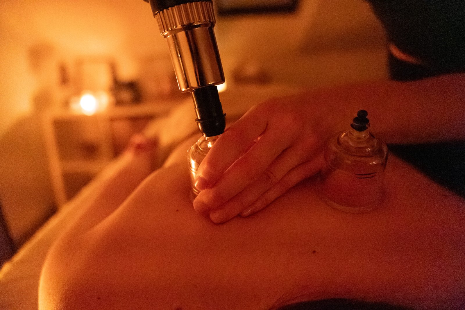 Terapija čašicama (cupping) na leđima u Lumina Studiju